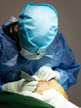 Hair Growth Surgery